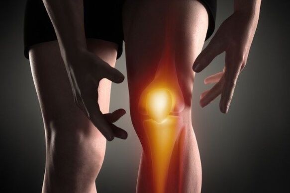 Arthrosis of the knee joint
