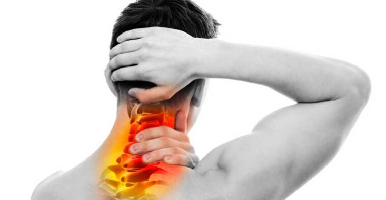 Pain in the neck and neck sign of an osteochondrosis