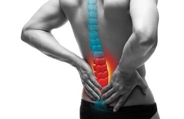 Osteochondrosis is a disease of the spine