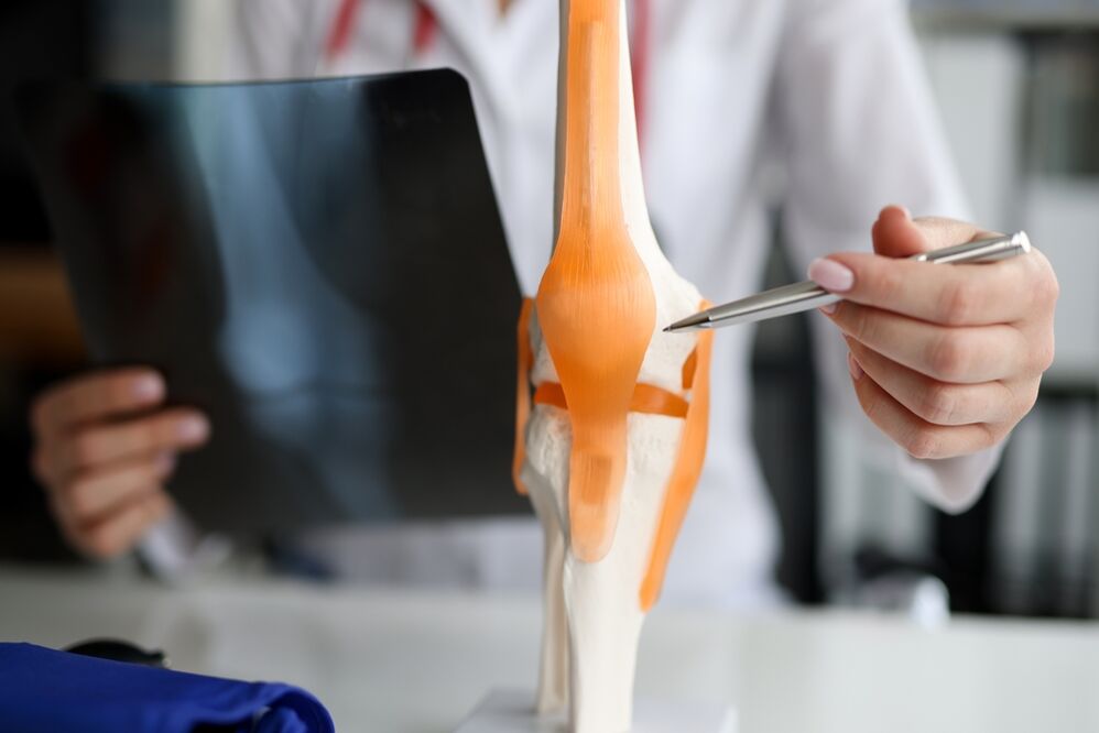 Representation of a joint in which degenerative changes lead to the development of osteoarthritis
