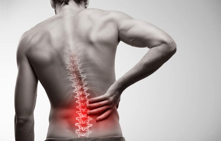 Lower back pain due to osteochondrosis